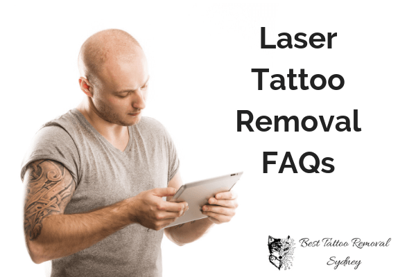 Laser Tattoo Removal FAQ