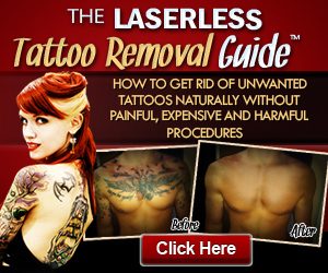 home tattoo removal